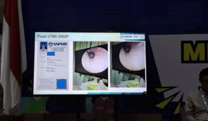 Panitia UTBK Universitas Diponegoro (Undip) menemukan peserta yang menyembunyikan alat bantu dengar yang terhubung dengan perangkat komunikasi di dalam telinga.