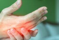 Tangan sering kesemutan dapat disebabkan oleh tekanan saraf, gangguan sirkulasi darah, kekurangan vitamin, hingga stres. Ketahui penyebab dan cara mengatasinya secara tepat.( Poto : Tribratanews Polri ).