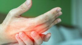 Tangan sering kesemutan dapat disebabkan oleh tekanan saraf, gangguan sirkulasi darah, kekurangan vitamin, hingga stres. Ketahui penyebab dan cara mengatasinya secara tepat.( Poto : Tribratanews Polri ).