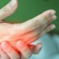Tangan sering kesemutan dapat disebabkan oleh tekanan saraf, gangguan sirkulasi darah, kekurangan vitamin, hingga stres. Ketahui penyebab dan cara mengatasinya secara tepat.( Poto : Tribratanews Polri ).